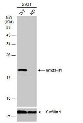 Western Blot: NM23-H1 Antibody [NBP2-19549]