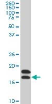 Western Blot: NM23-H2/NME2 Antibody (1A9) [H00004831-M09]