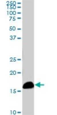 Western Blot: NM23-H2/NME2 Antibody (1A9) [H00004831-M09]