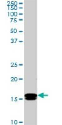 Western Blot: NM23-H2/NME2 Antibody (1A9) [H00004831-M09]