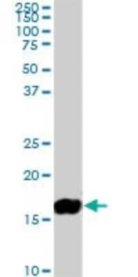 Western Blot: NM23-H2/NME2 Antibody (1A9) [H00004831-M09]