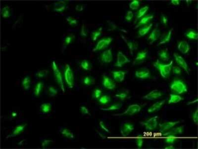 Immunocytochemistry/ Immunofluorescence: NM23-H2/NME2 Antibody (1D3) [H00004831-M06]