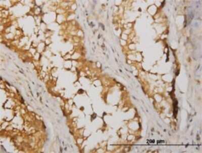 Immunohistochemistry-Paraffin: NM23-H2/NME2 Antibody (1D3) [H00004831-M06]