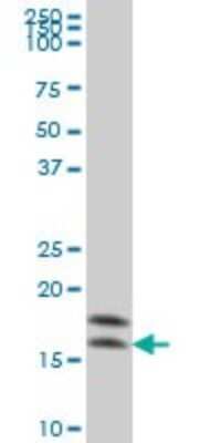 Western Blot: NM23-H2/NME2 Antibody (1D3) [H00004831-M06]