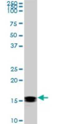 Western Blot: NM23-H2/NME2 Antibody (1D3) [H00004831-M06]
