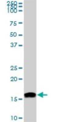 Western Blot: NM23-H2/NME2 Antibody (1D3) [H00004831-M06]