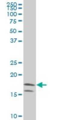 Western Blot: NM23-H2/NME2 Antibody (1E4) [H00004831-M11]