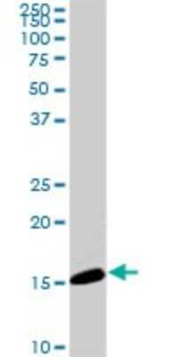 Western Blot: NM23-H2/NME2 Antibody (1E4) [H00004831-M11]
