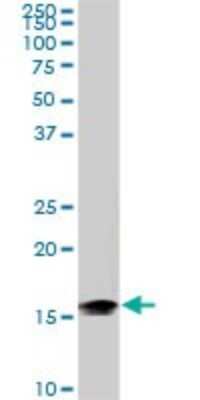 Western Blot: NM23-H2/NME2 Antibody (1E4) [H00004831-M11]