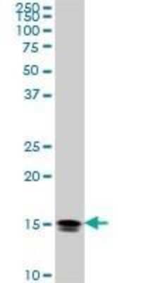 Western Blot: NM23-H2/NME2 Antibody (1E4) [H00004831-M11]