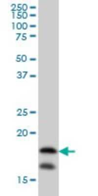 Western Blot: NM23-H2/NME2 Antibody (1F2) [H00004831-M08]