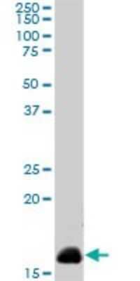 Western Blot: NM23-H2/NME2 Antibody (1F2) [H00004831-M08]