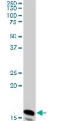 Western Blot: NM23-H2/NME2 Antibody (1F2) [H00004831-M08]