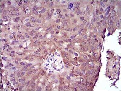 Immunohistochemistry-Paraffin: NM23-H2/NME2 Antibody (4G7A8) - BSA Free [NBP2-52519]
