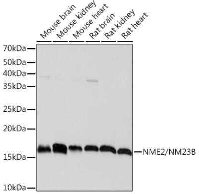 Western Blot: NM23-H2/NME2 Antibody (7L3A2) [NBP3-16606]