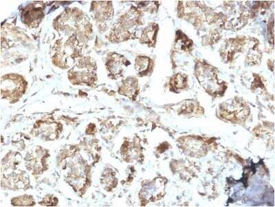 Immunohistochemistry-Paraffin: NM23-H2/NME2 Antibody (CPTC-NME2-2) - Azide and BSA Free [NBP2-79873]