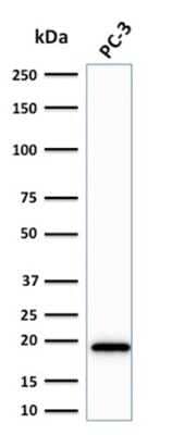 Western Blot: NM23-H2/NME2 Antibody (CPTC-NME2-2)Azide and BSA Free [NBP2-79873]