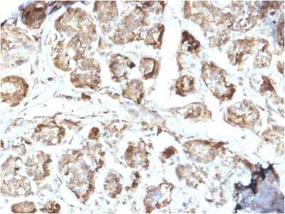 Immunohistochemistry-Paraffin: NM23-H2/NME2 Antibody (CPTC-NME2-2) [NBP2-79738]