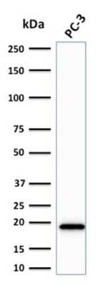 Western Blot: NM23-H2/NME2 Antibody (CPTC-NME2-2) [NBP2-79738]