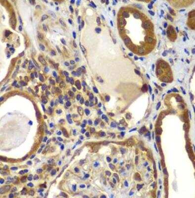 Immunohistochemistry-Paraffin: NM23-H2/NME2 Antibody - BSA Free [NBP3-05624]
