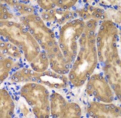 Immunohistochemistry-Paraffin: NM23-H2/NME2 Antibody - BSA Free [NBP3-05624]
