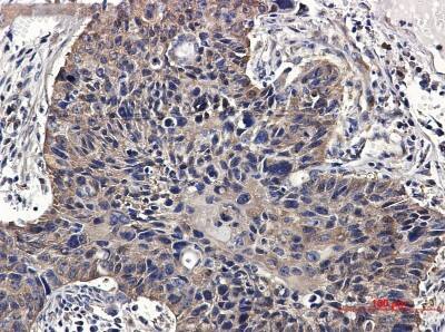 Immunohistochemistry-Paraffin: NM23-H2/NME2 Antibody (S08-1C1) [NBP3-19896]