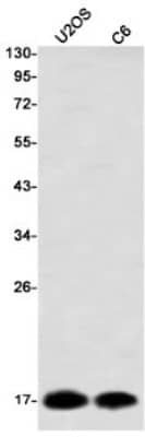 Western Blot: NM23-H2/NME2 Antibody (S08-1C1) [NBP3-19896]