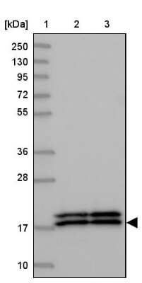Western Blot: NM23-H1 Antibody [NBP2-13662]