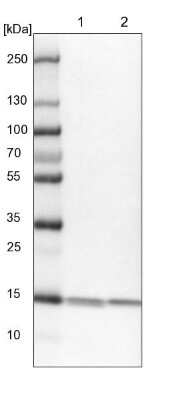 Western Blot: NM23-H1 Antibody [NBP2-13662]