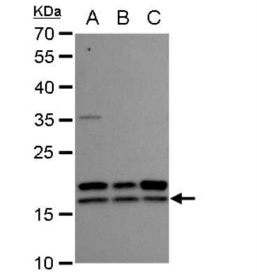 Western Blot: NM23-H2/NME2 Antibody [NBP2-19552]