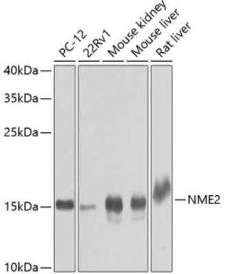 Western Blot: NM23-H2/NME2 AntibodyBSA Free [NBP3-05624]