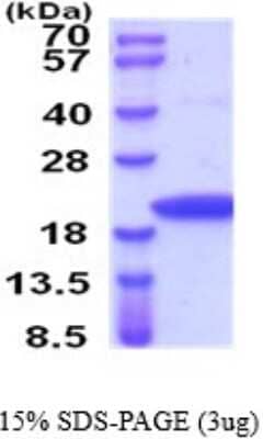 SDS-PAGE: Recombinant Rat NM23-H2/NME2 His Protein [NBP2-52153]