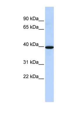 Western Blot: Neuromedin BR/NMBR Antibody [NBP1-59024]