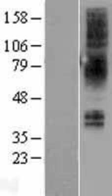 Western Blot: Neuromedin BR/NMBR Overexpression Lysate [NBL1-13680]