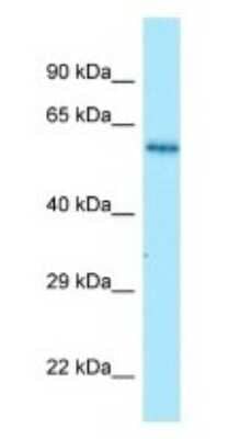 Western Blot: NMD3 Antibody [NBP1-98594]