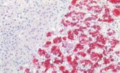 Immunohistochemistry-Paraffin: NMDAR1 Antibody [NBP3-14423]