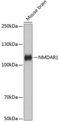 Western Blot: NMDAR1 Antibody (1H1T3) [NBP3-15431]