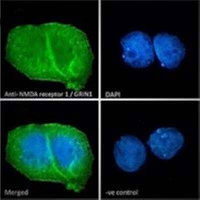 Immunocytochemistry/ Immunofluorescence: NMDAR1 Antibody [NB100-41105]