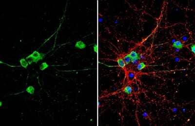 Immunocytochemistry/ Immunofluorescence: NMDAR1 Antibody [NBP3-13158]