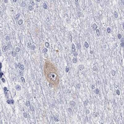 Immunohistochemistry-Paraffin: NMDAR1 Antibody [NBP3-17902]