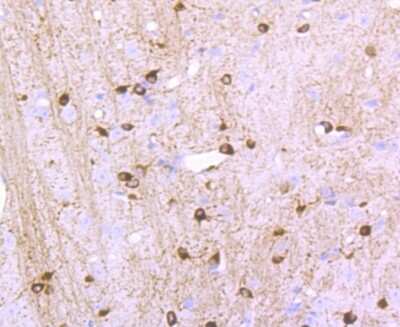 Immunohistochemistry-Paraffin: NMDAR1 Antibody (JM11-26) [NBP2-66982]