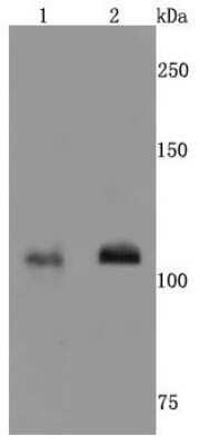 Western Blot: NMDAR1 Antibody (JM11-26) [NBP2-66982]