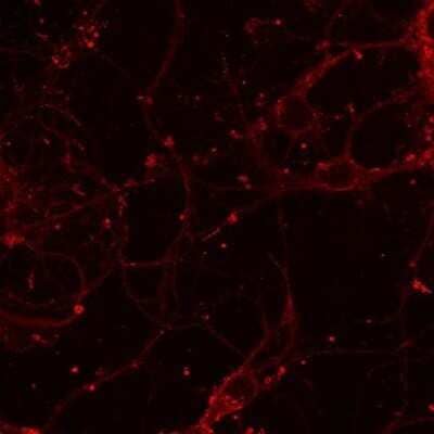 Immunocytochemistry/ Immunofluorescence: NMDAR1 Antibody (R1JHL) - Azide and BSA Free [NB300-118]