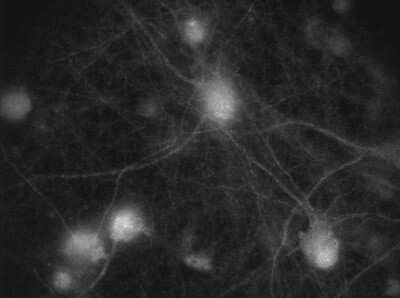 Immunocytochemistry/ Immunofluorescence: NMDAR1 Antibody (R1JHL) - Azide and BSA Free [NB300-118]