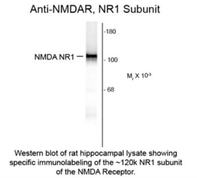 Western Blot: NMDAR1 Antibody (R1JHL)Azide and BSA Free [NB300-118]