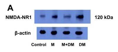 Western Blot: NMDAR1 Antibody (R1JHL)Azide and BSA Free [NB300-118]