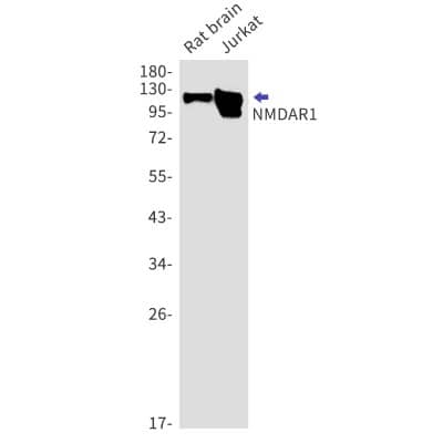 Western Blot: NMDAR1 Antibody (S08-4B6) [NBP3-19718]