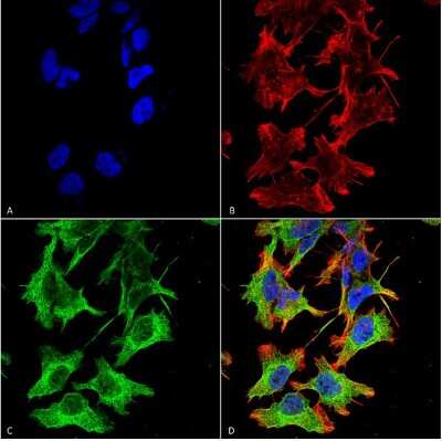 Immunocytochemistry/ Immunofluorescence: NMDAR1 Antibody (S308-48) [NBP2-59327]