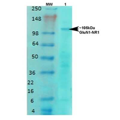 Western Blot: NMDAR1 Antibody (S308-48) [NBP2-59327]