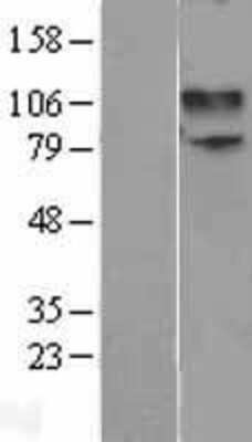 Western Blot: NMDAR1 Overexpression Lysate [NBL1-11338]